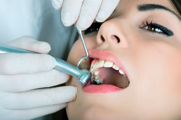 Choosing The Right Tooth Filling For You